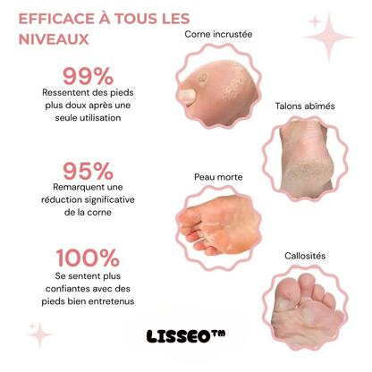 Lisseo™ - Kit Beauté Pieds