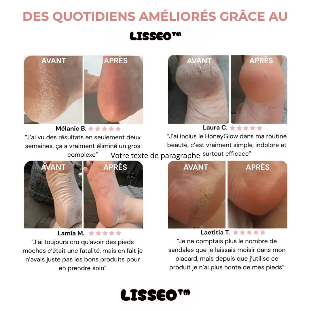 Lisseo™ - Kit Beauté Pieds