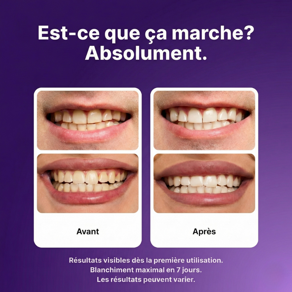 Bandes Blanchissantes  - Smilekit™